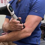 Using Shockwave on the elbow