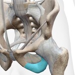 Picture of the Femoral Head