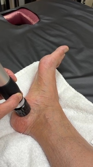 Shockwave treatment on a foot